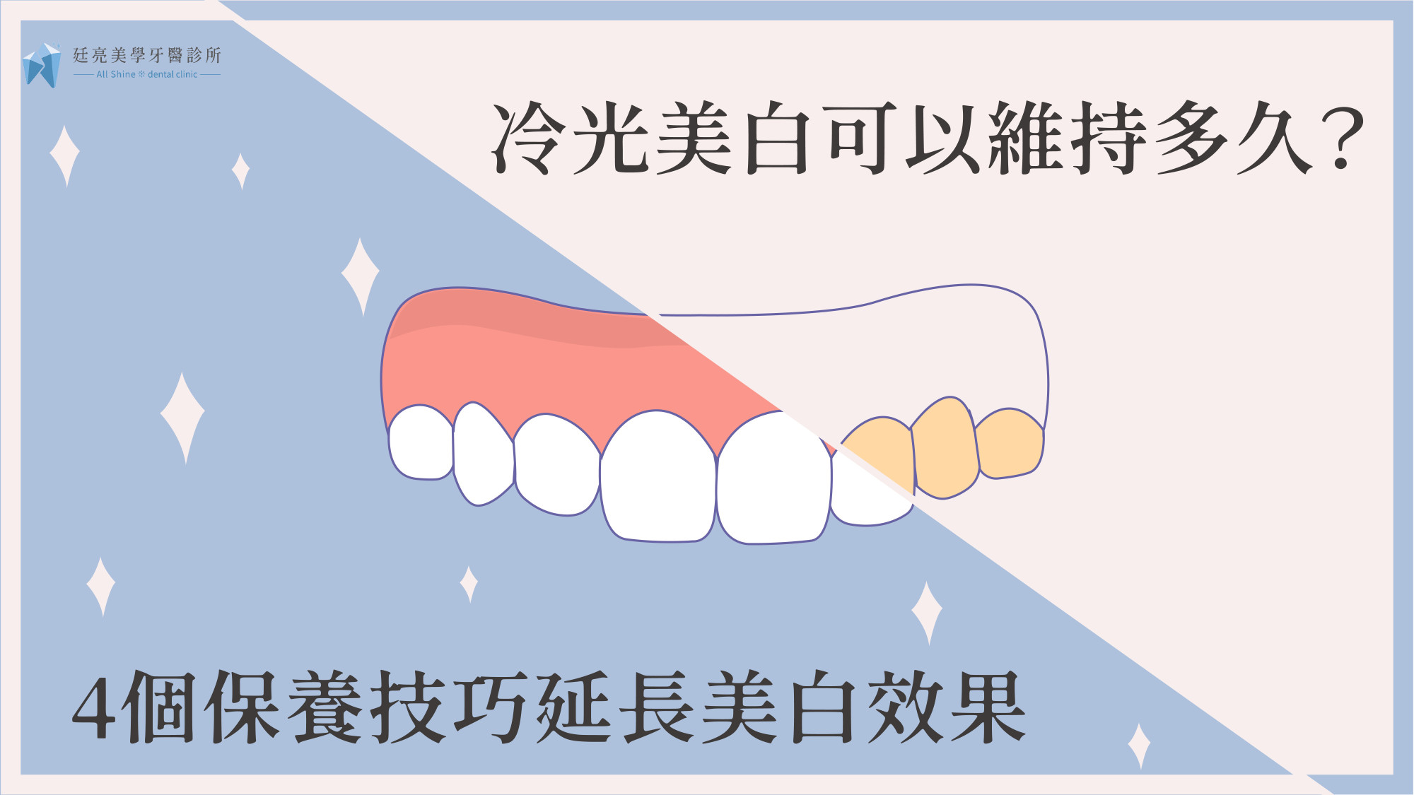 冷光美白可以維持多久？4個保養技巧延長美白效果
