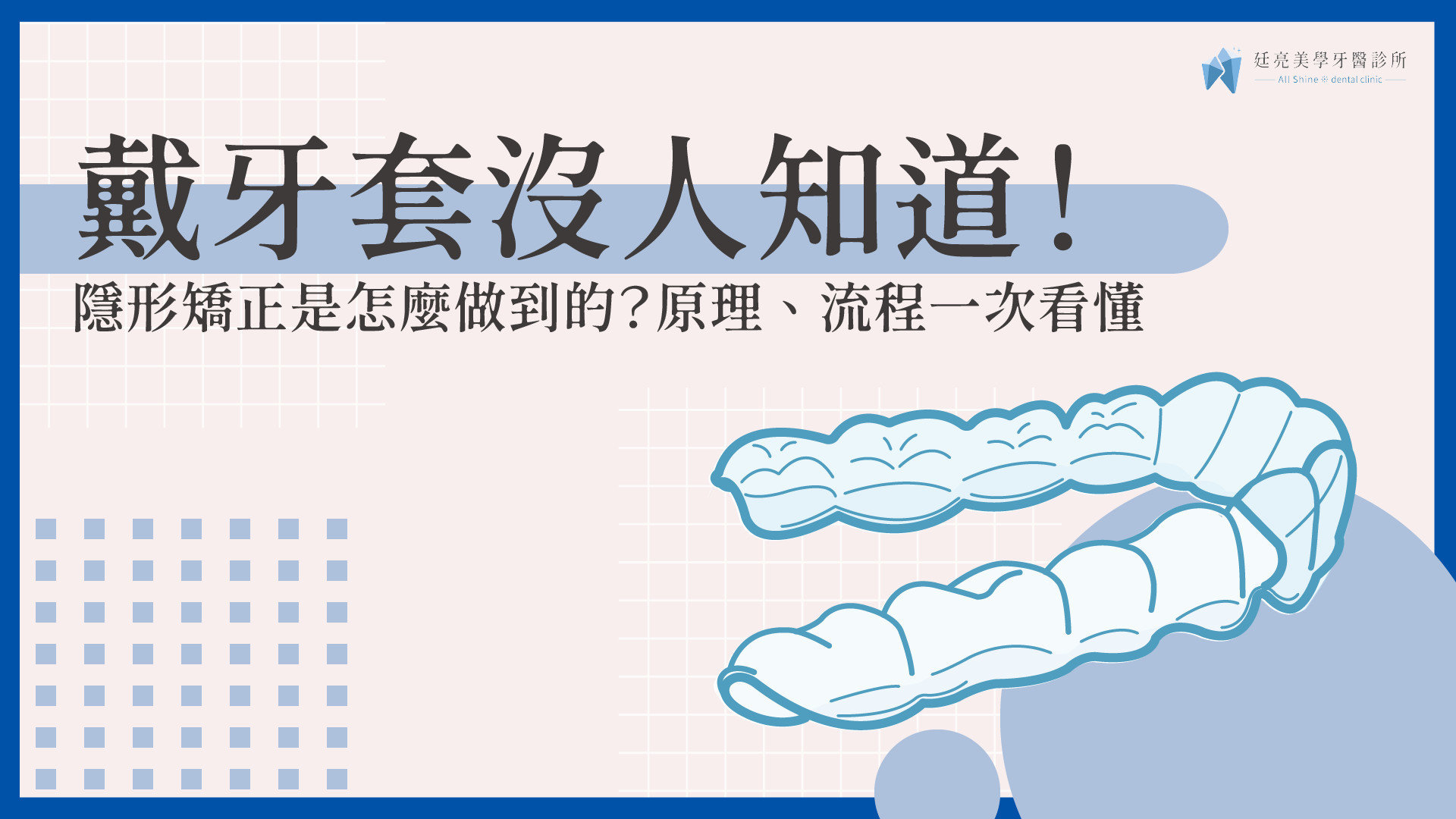 戴牙套沒人知道！隱形矯正是怎麼做到的？原理、流程一次看懂