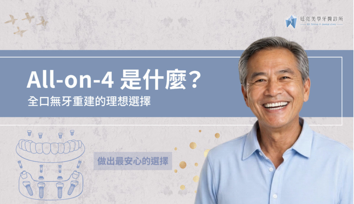 All-on-4 是什麼？全口無牙重建的理想選擇