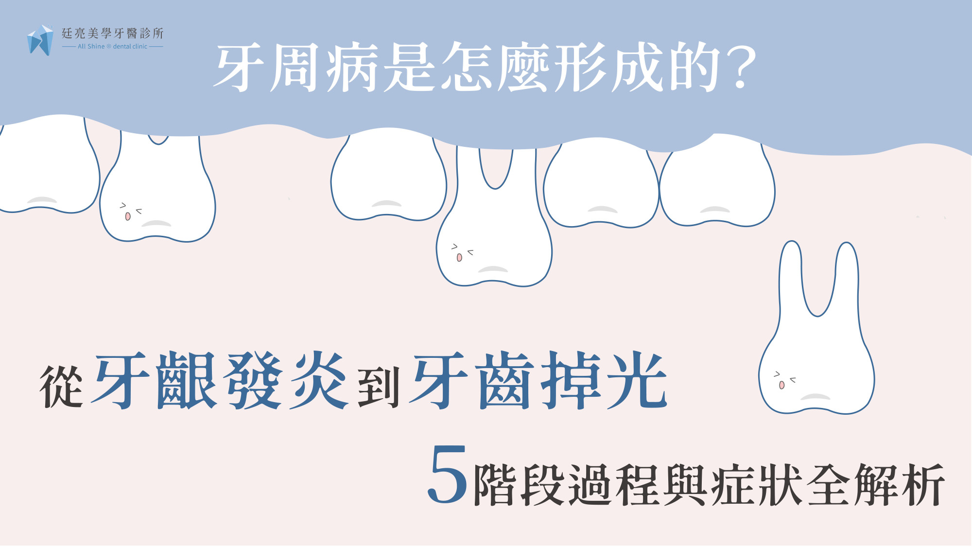 牙周病是怎麼形成的？從「牙齦發炎」到「牙齒掉光」的5階段過程與症狀全解析